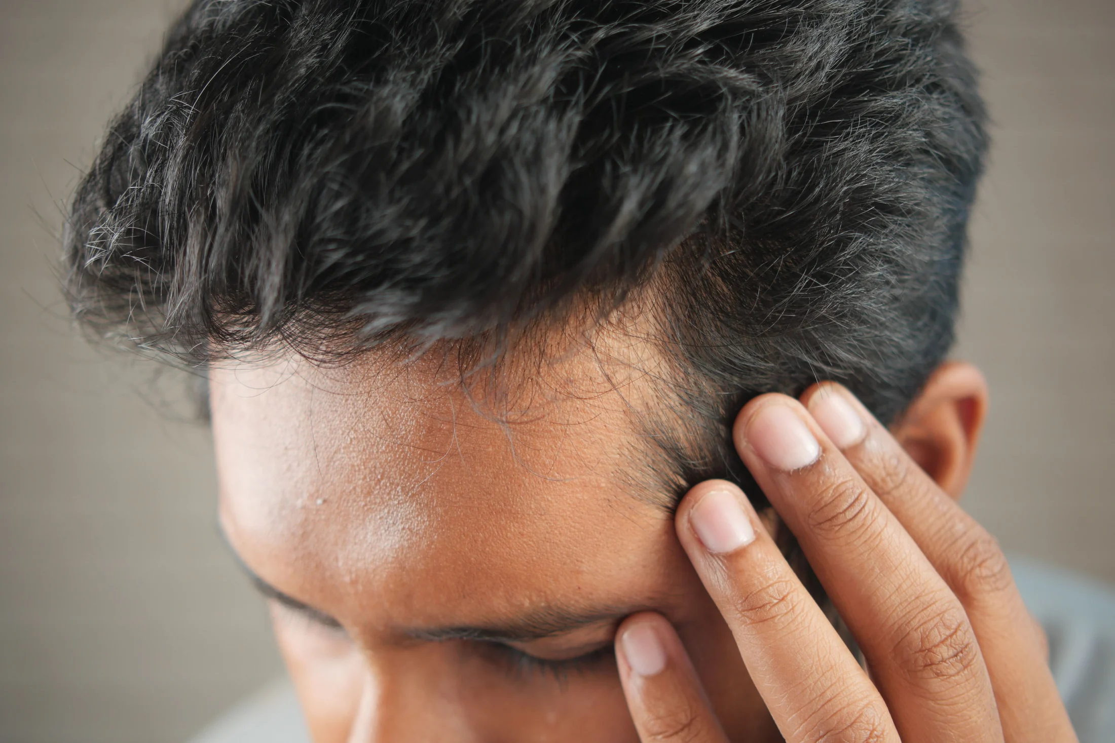 Hair loss